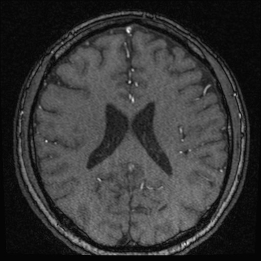 Click on the Serie image to view the images of VILLANUEVA, WILLIAM A.